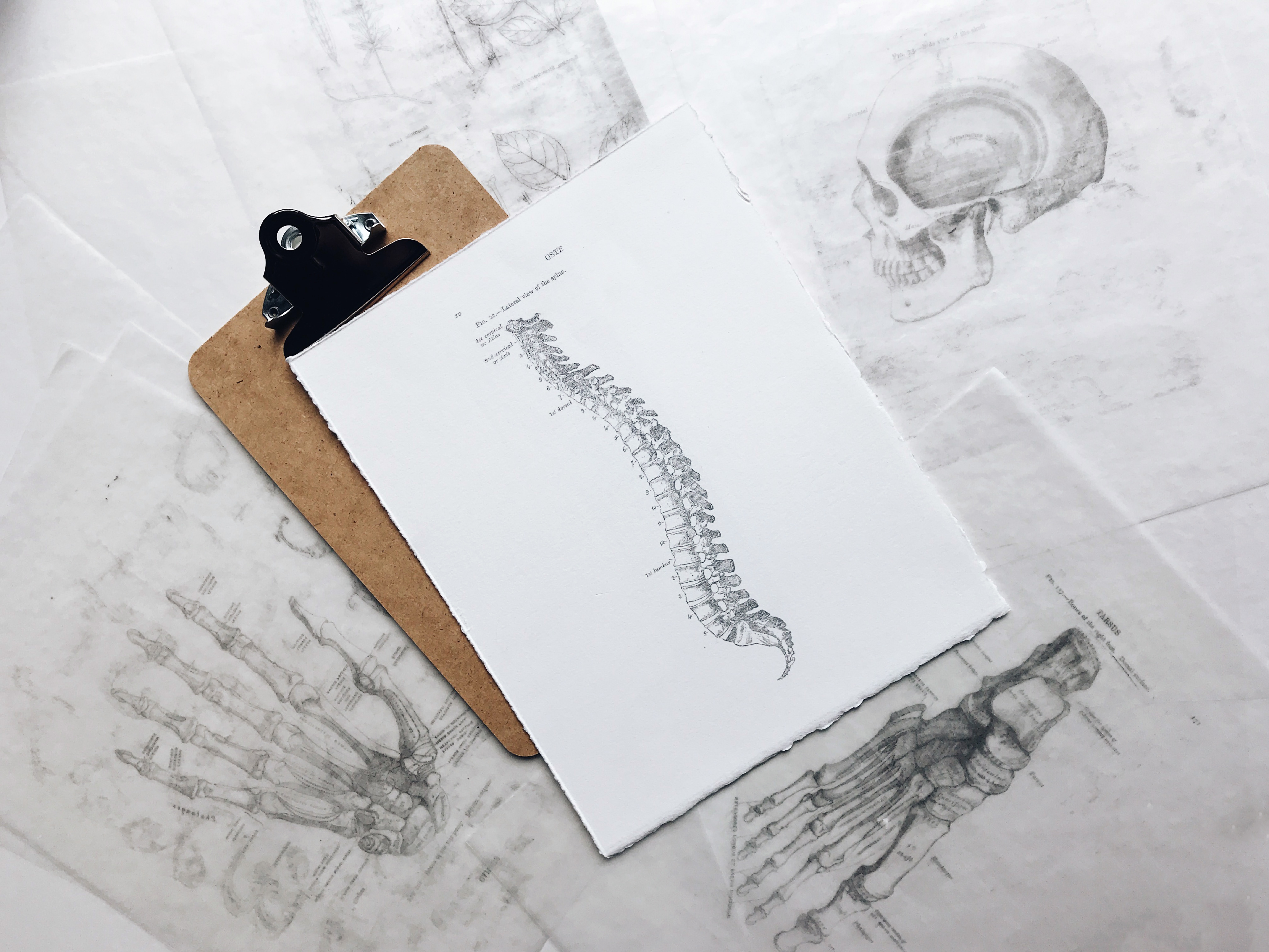 Tips for preventing a herniated disc - Physiofinder