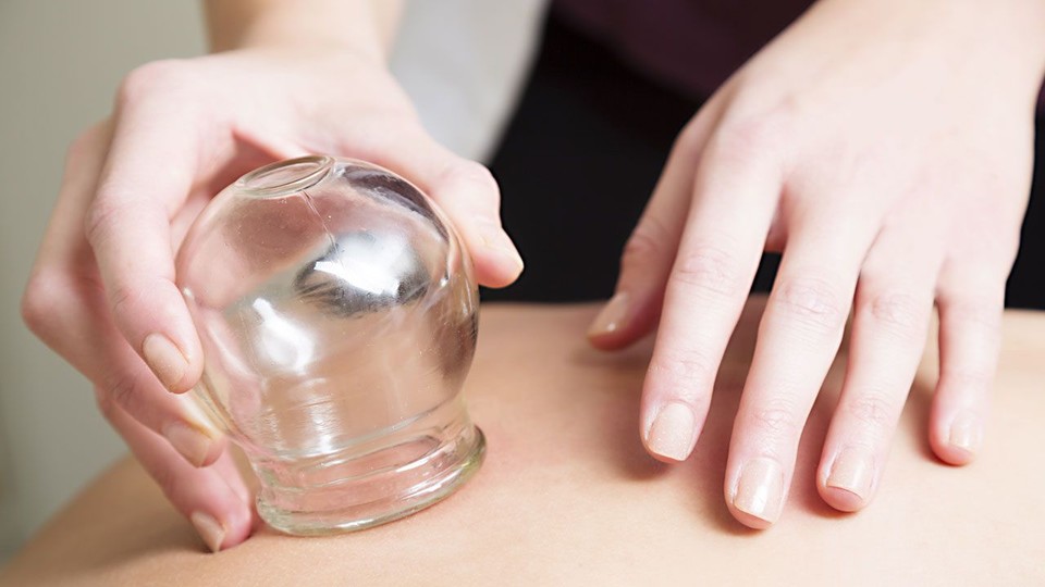 Physiotherapeut - Rheinland-Pfalz - unblutiges Schröpfen, Schröpfmassage - Therapiezentrum Mittelrhein Praxis für Physiotherapie, Ergotherapie und Lymphdrainage